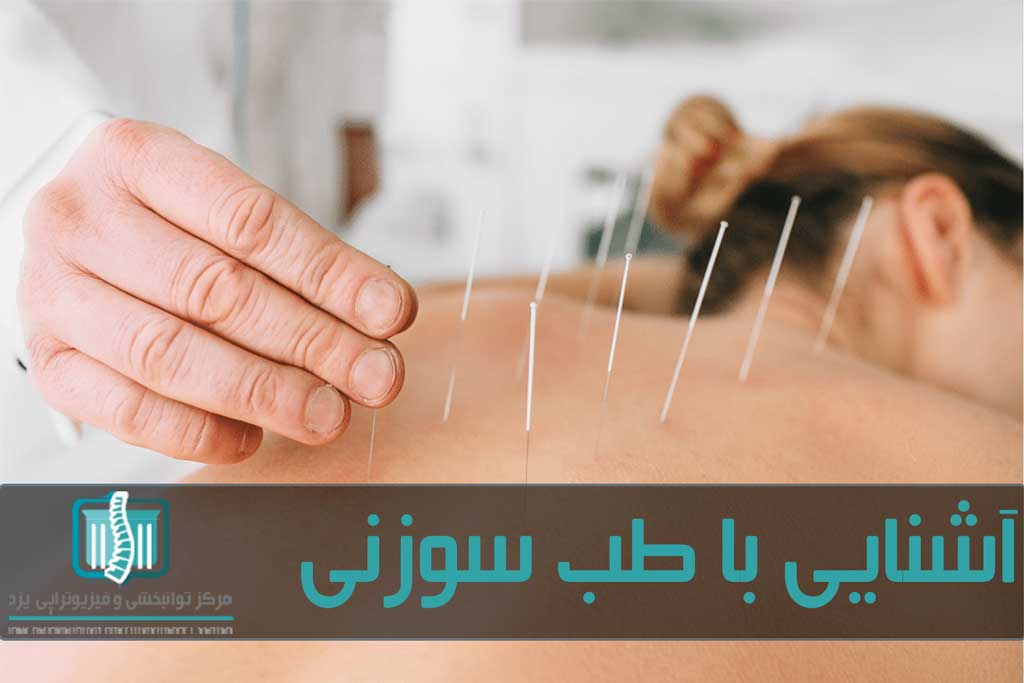 درد چندانی در طب سوزنی احساس نمی شود