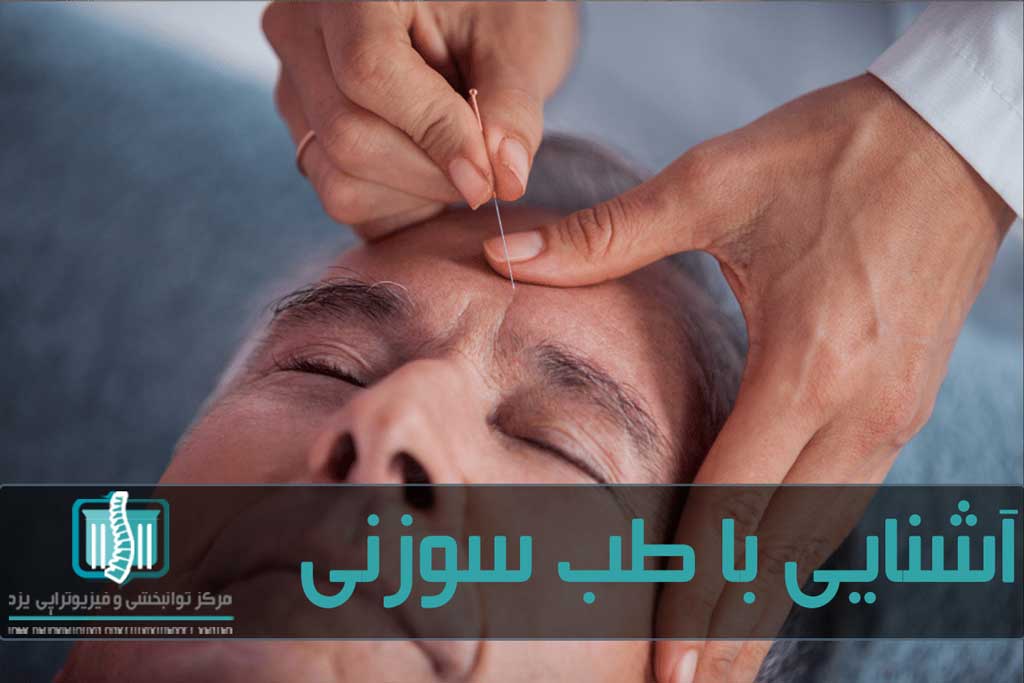 طب سوزنی برای افراد با فشار خون بالا نباید استفاده شود