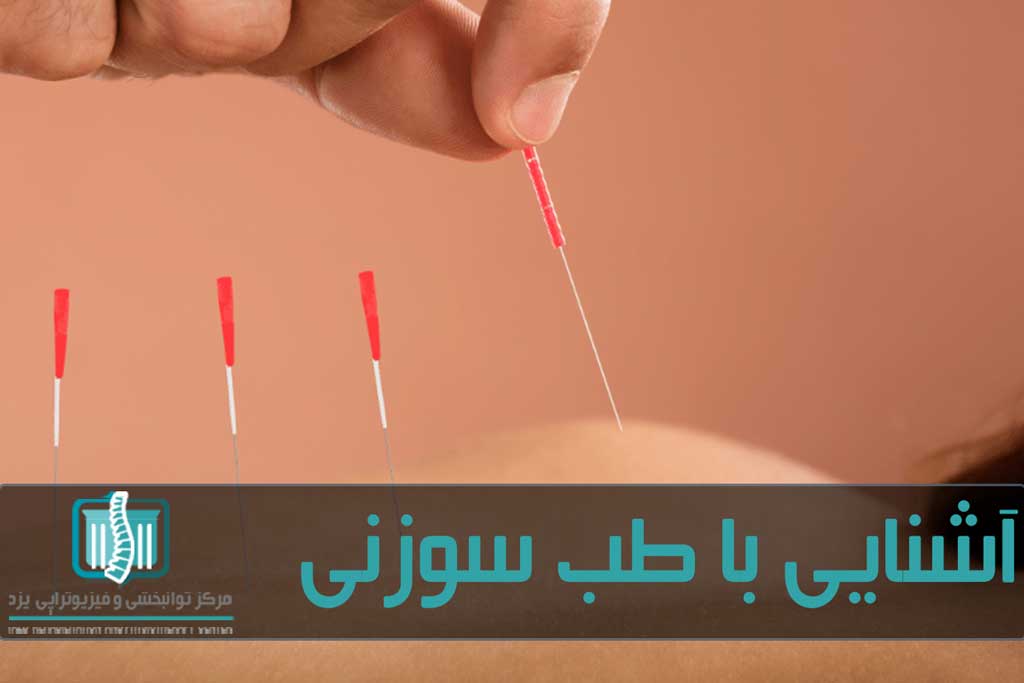 تعداد جلسات طب سوزنی بر اساس نوع و شدت آسیب تعیین می شود