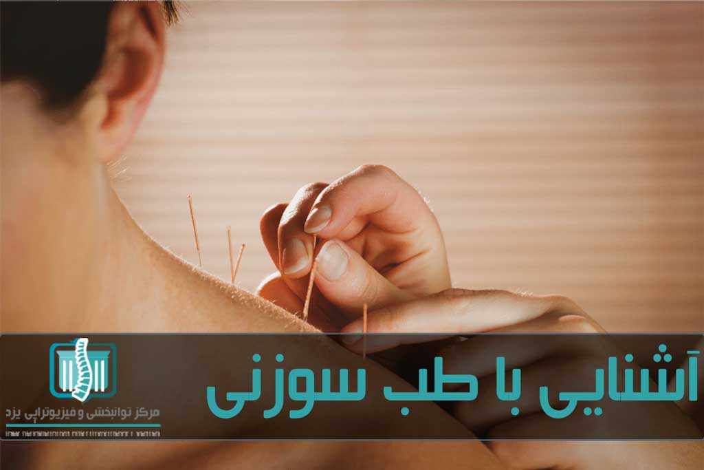 طب سوزنی بر اساس تعادل یین و یانگ در بدن کار می کند