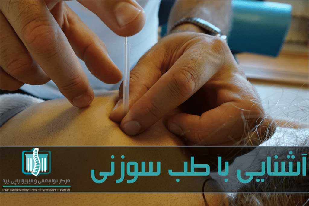 تفاوت اصلی طب سوزنی با سوزن خشک در نگاه آنها به علت بیماری است