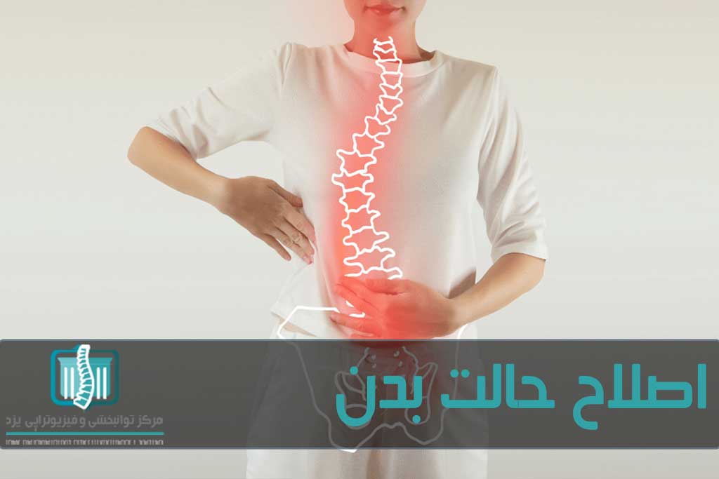 هرچه زودتر برای اصلاح حالت بدن اقدام کنید