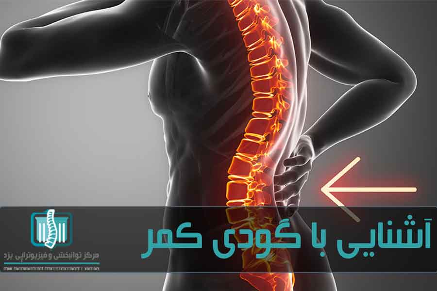 گودی کمر آسیبی است که کمر و شکم را به سمت جلو می کشد