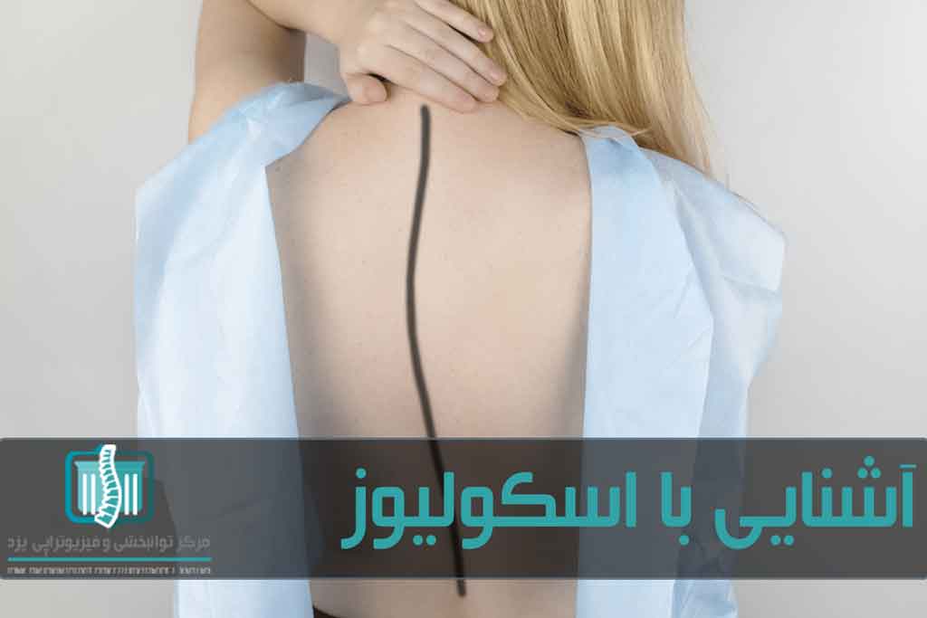 پزشک با ارزیابی فیزیکی می‌تواند کجی ستون فقرات را تشخیص دهد