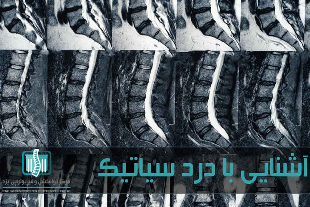 پزشک با ارزیابی فیزیکی و آزمایش‌های تصویربرداری نوع بیماری کمر را تشخیص می‌دهد