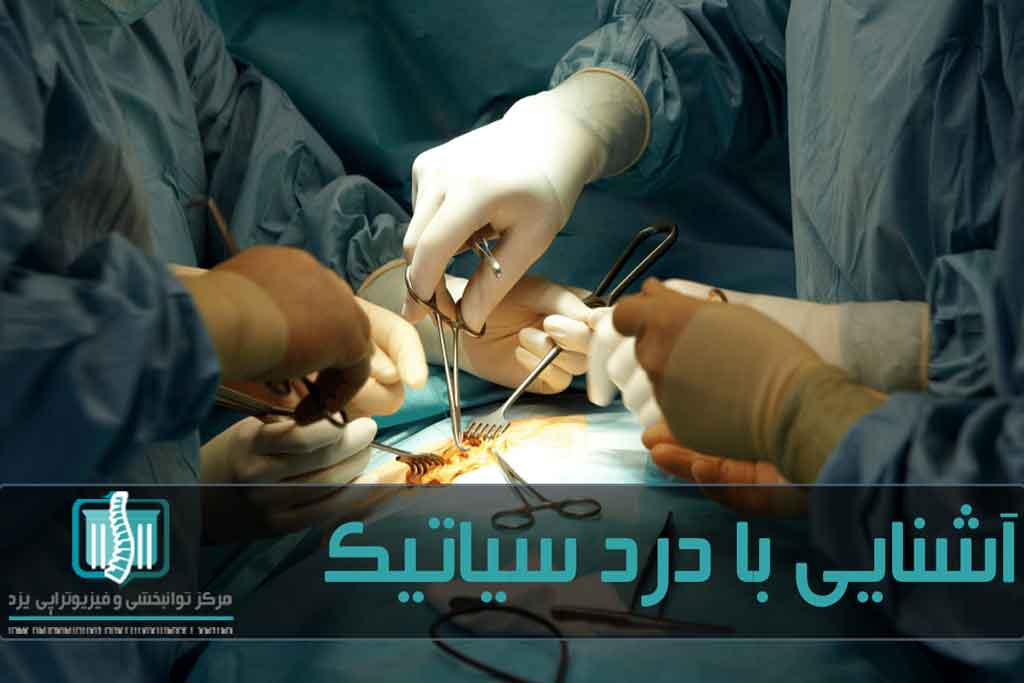 درد سیاتیک معمولا با فیزیوتراپی درمان می‌شود اما موارد حاد ممکن است به جراحی نیاز داشته باشد