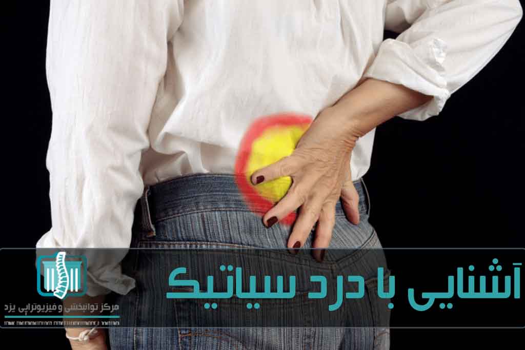 برای درمان درد سیاتیک باید ابتدا از درمان‌های خانگی شروع کرد