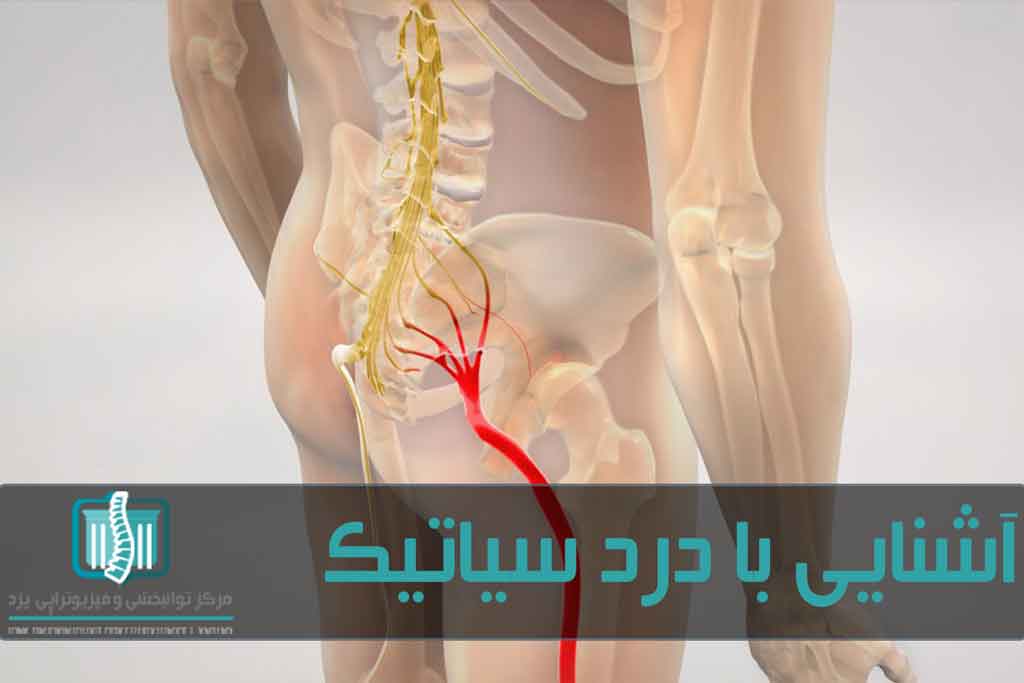 عصب سیاتیک از نخاع شروع می‌شود و به سمت پاها کشیده می‌شود