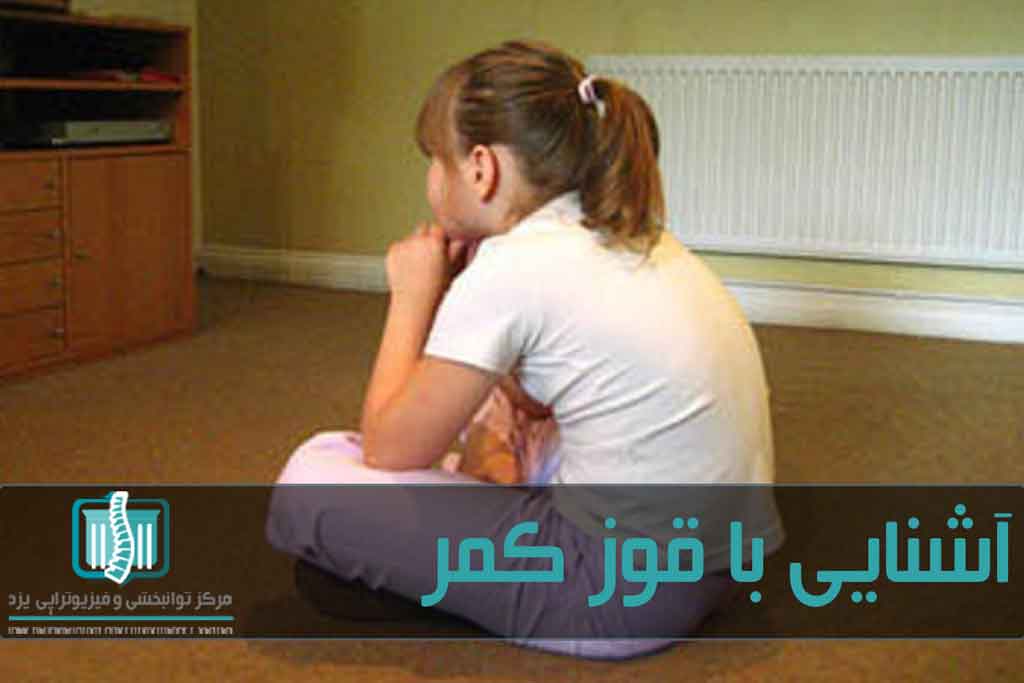 رعایت‌نکردن حالت صحیح بدن از اصلی‌ترین علت‌های بروز کیفوز وضعیتی است