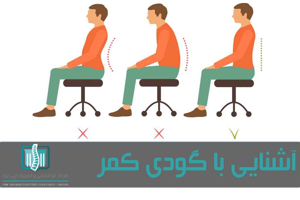 برای پیشگیری از گودی کمر باید حالت صحیح نشستن را رعایت کرد