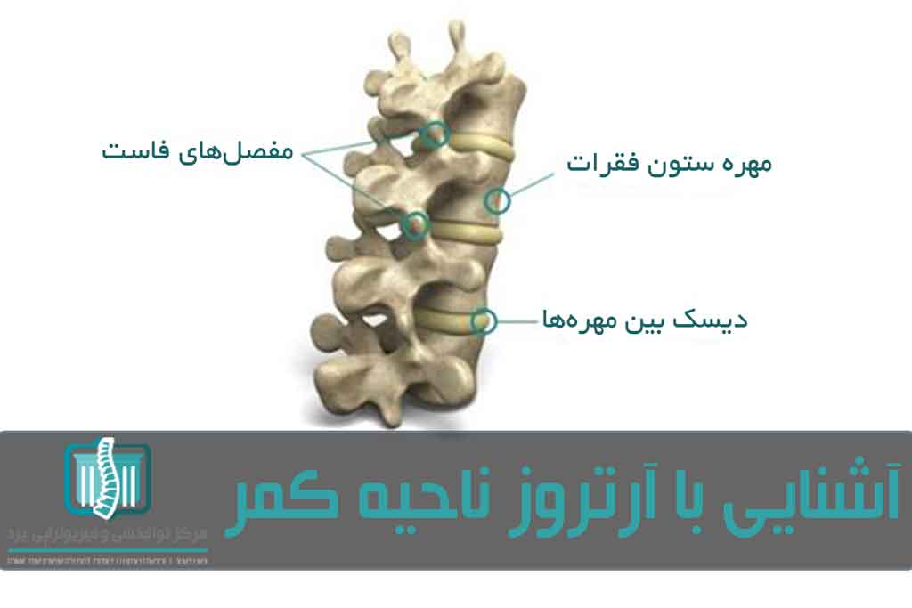 آرتروز کمر در واقع همان آرتروز ستون فقرات است که در ناحیه کمر اتفاق می‌افتد