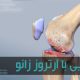 آرتروز زانو شایع‌ترین نوع بیماری التهابی آرتریت است
