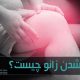 قفل شدن زانو یکی از آسیب‌های آزاردهنده است که در دوحالت واقعی و کاذب اتفاق می‌افتد