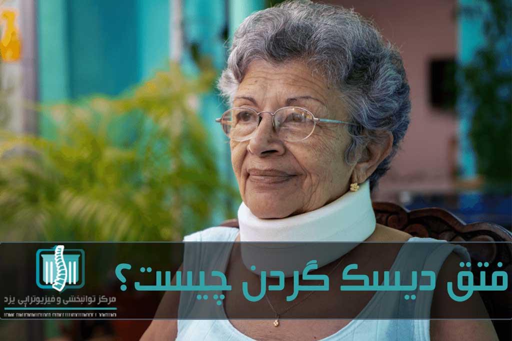 زنان میانسال ریسک بیشتری برای ابتلا به آسیب دیسک گردن دارند