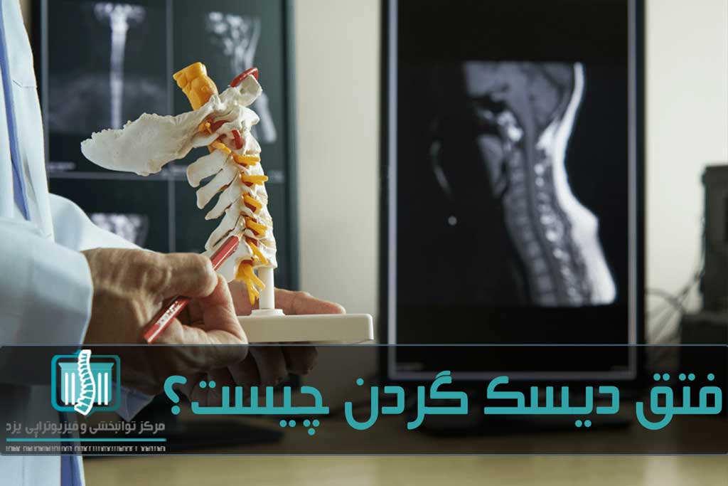 پزشک با ارزیابی فیزیکی و آزمایش تصویربرداری آسیب را شخیص می‌دهد