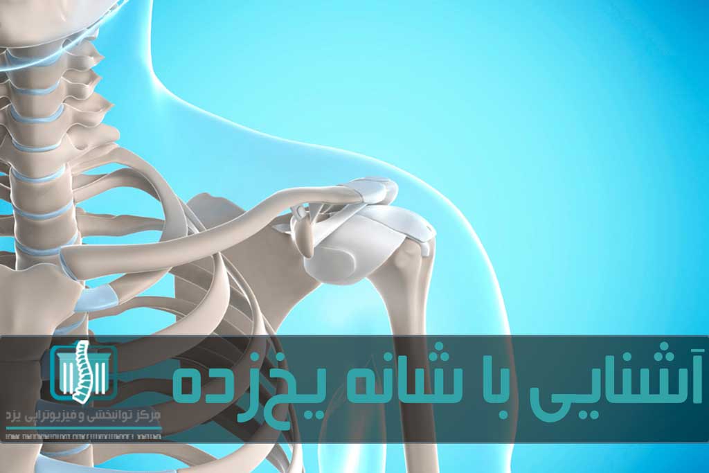 شانه یخ‌زده بیشتر در اثر بی‌تحرکی و بیماری‌های زمینه‌ای ایجاد می‌شود
