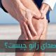 صدا دادن زانو به‌خودی‌خود خطرناک نیست اما گاهی نشانه بیماری است