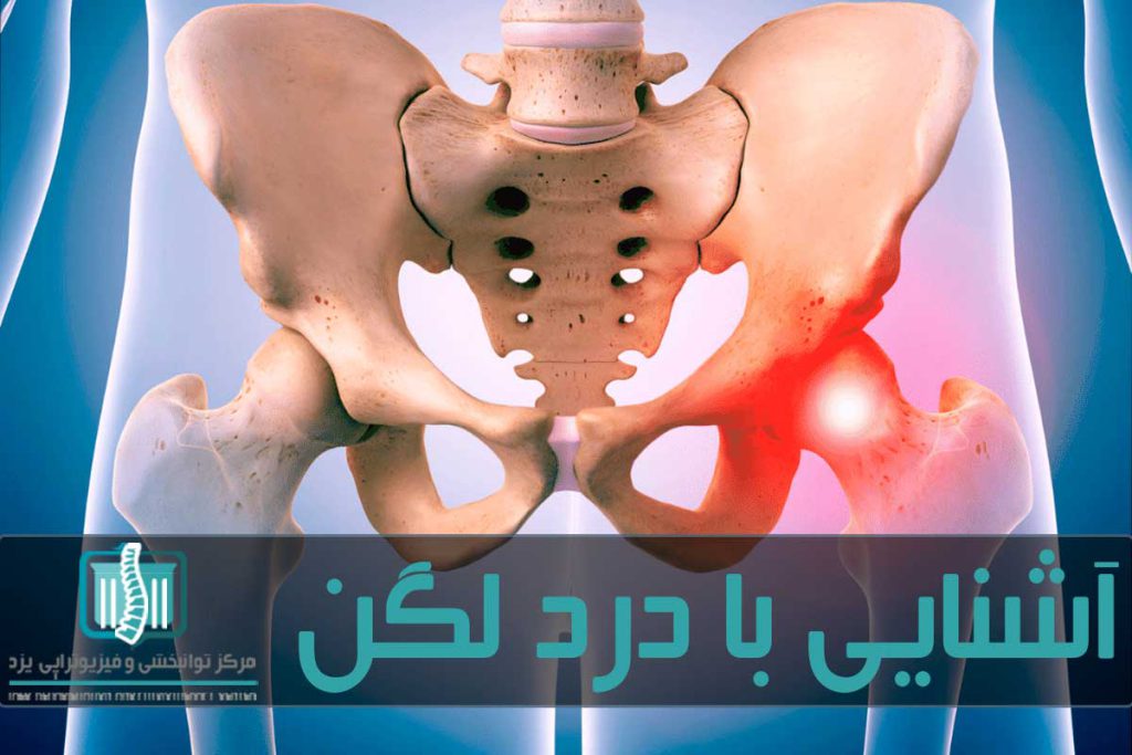 با تمرین درمانی و فیزیوتراپی میتواند درد در لگن را درمان کرد