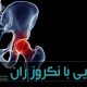 نکروز آواسکولار بیماری‌ای است که در اثر نرسیدن خون به سز استخوان ران ایجاد می‌شود