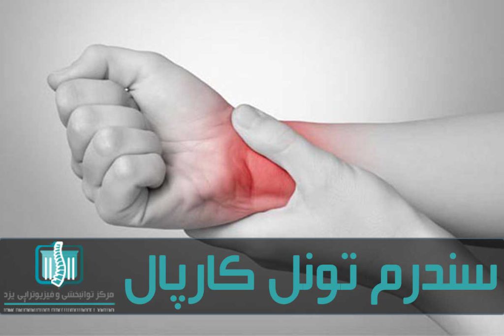 تونل کارپال معمولا با فیزیوتراپی درمان می‌شود