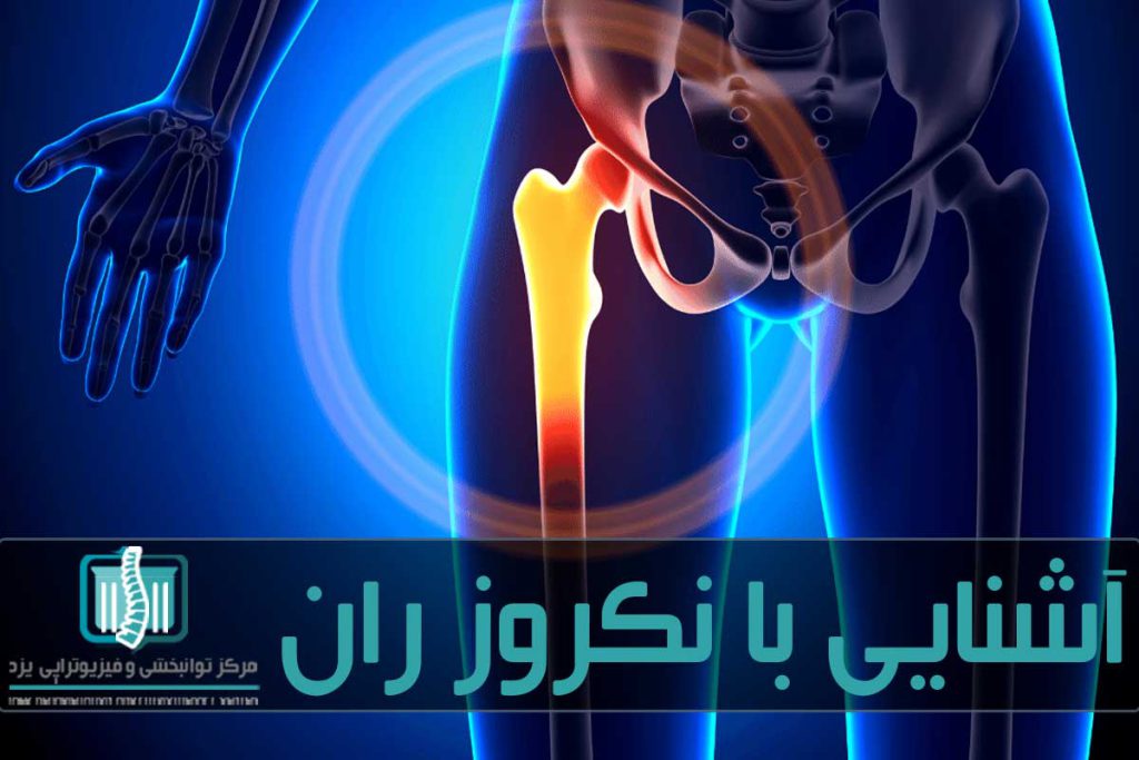 مصرف برخی داروها، تجمع چربی و بیماری‌های زمینه‌ای از عوامل بروز نکروز ران است